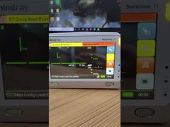 See Why Choose Mindray BeneView T1 Patient Monitor LCD Screen With Front Cover