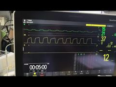 View Mindray AG Module AG And O2 Module MMS Module PN 115-023943-00 Demo
