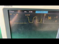 A Closer Look: Mindray Water Trap For 9200-10-10530 Adult Pediatric Anesthesia Gas Module