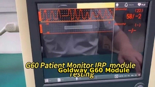 Goldway G60 Patient Monitor Module Repair